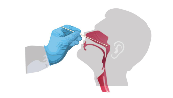 rinofarigiko epixrisma